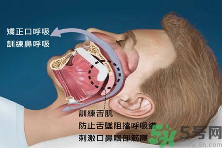 耳鳴是什么原因引起的？耳鳴怎么治療最好？