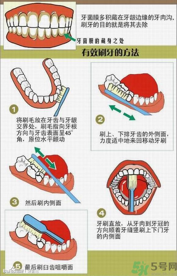 18歲還能戴牙套嗎？戴牙套真的能瘦臉改變臉型嗎？