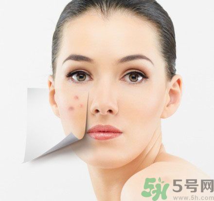 臉上有斑怎么去除？祛斑的小偏方有哪些？