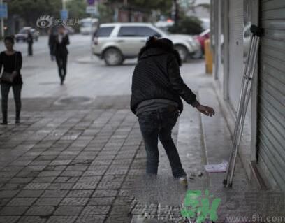學(xué)生患東方美女病是怎么回事？東方美女病是什么病？