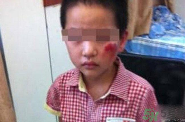 男孩遭校長(zhǎng)暴打的結(jié)果是什么？男孩遭校長(zhǎng)暴打的真相是什么？
