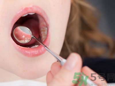早上起床嘴苦是怎么回事？嘴苦怎么調理？