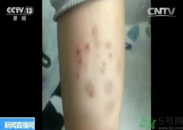 被污染學校是哪個？500師生患病的原因？