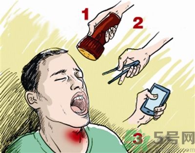 魚刺卡喉喝醋可以治療嗎？魚刺卡喉喝醋好不好？