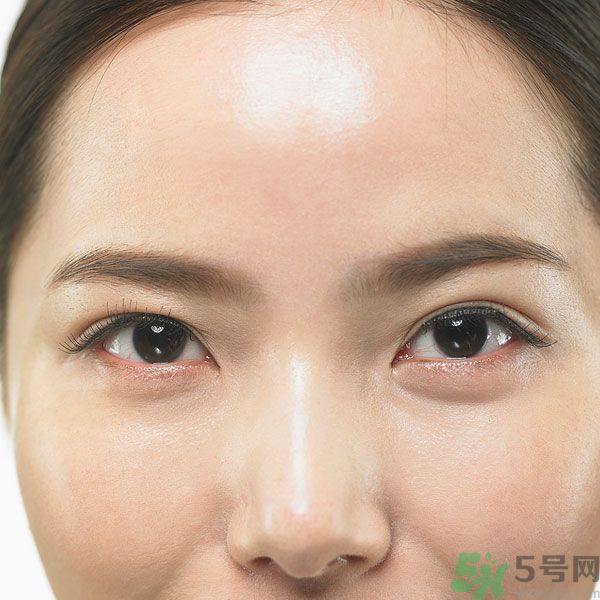眉周紋是怎么形成的？眉周紋怎么去除？