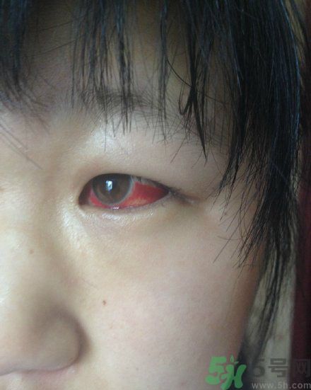 初中生全體甲醛中毒是怎么回事？初中生全體甲醛中毒是哪個(gè)學(xué)校？