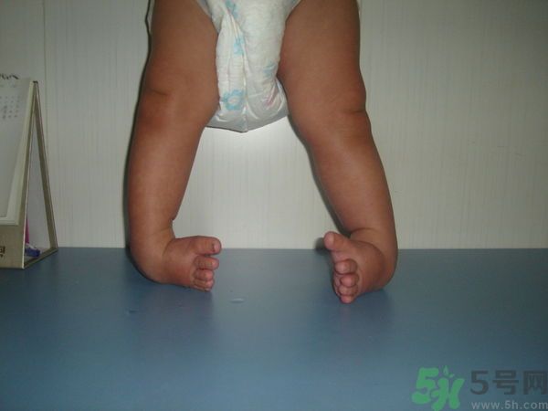 女生3天花8萬(wàn)是怎么回事？馬蹄足是什么?。? width=
