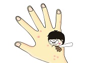 蚊子叮的包過(guò)幾天又癢是為什么？蚊子叮的包過(guò)幾天又癢怎么辦？