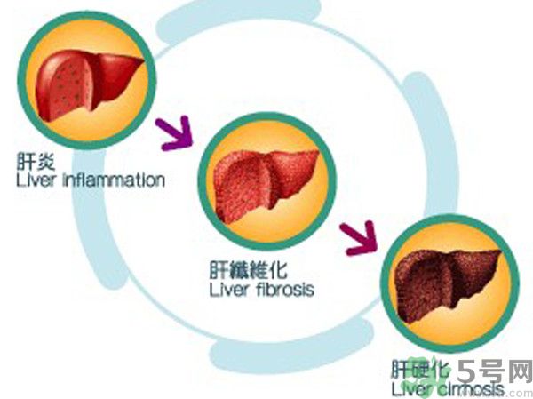 在外面吃飯會得乙肝嗎？在食堂吃飯會得乙肝嗎？