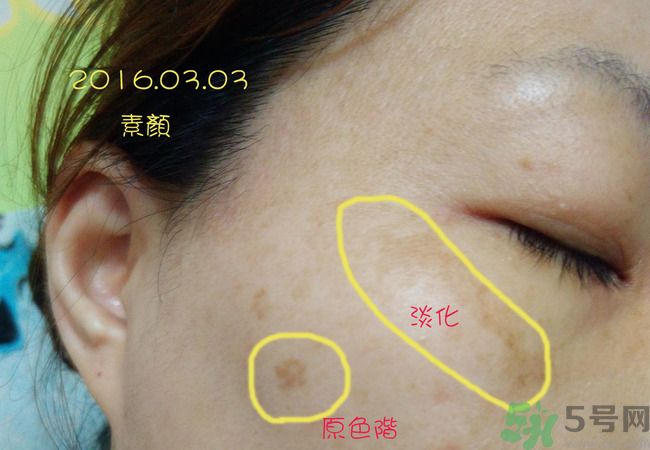 sk2祛斑精華怎么樣？skii祛斑精華使用方法