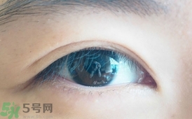 單眼皮怎么變雙眼皮了？單眼皮上面有一條線