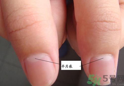指甲沒有月牙是什么原因？指甲沒有月牙怎么調(diào)理？