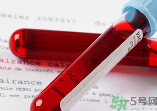 獻(xiàn)血后可以洗澡嗎？抽血后可以洗澡嗎？