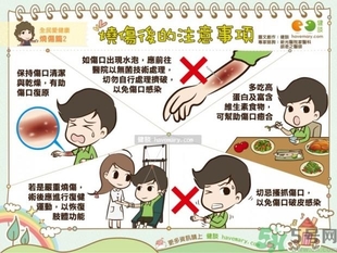 手被油燙傷了怎么處理？手被油燙起泡了怎么辦？