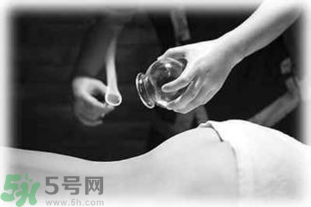 大暑可以拔罐嗎？大暑拔罐好不好？