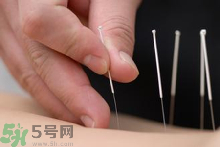 大暑可以針灸嗎？大暑針灸好不好？