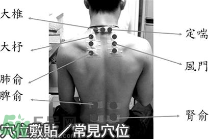 經(jīng)期可以貼三伏貼嗎？來(lái)月經(jīng)可以貼三伏貼嗎？