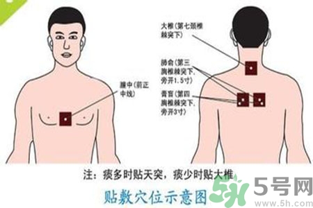 肝炎貼三伏貼有用嗎？肝病貼三伏貼貼哪里？
