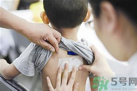 三伏貼能治頸椎病嗎？頸椎病三伏貼穴位