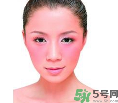 敏感性皮膚用什么洗面奶？敏感性皮膚怎么修復(fù)？