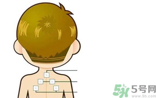 三伏貼可以去濕氣嗎？三伏貼去濕氣貼哪里？