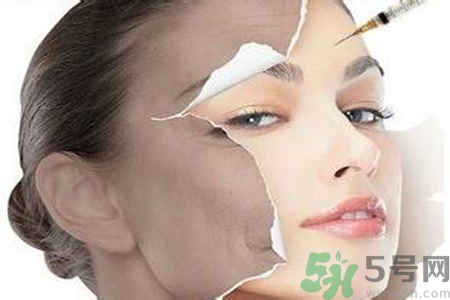 美白針效果怎么樣？美白針有副作用嗎？