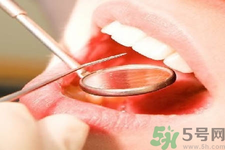 冷光美白牙齒是什么？冷光美白牙齒的好處有哪些？