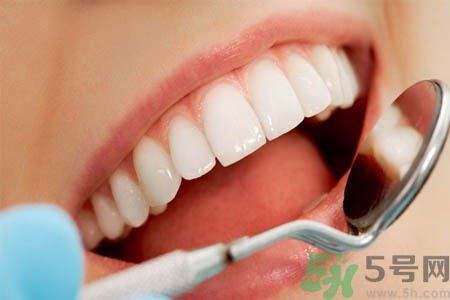 冷光美白牙齒的價(jià)格是多少？做冷光美白牙齒需要多少錢(qián)？