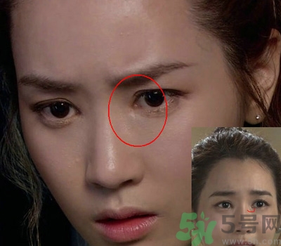 開眼角多少錢？開眼角有什么危害？