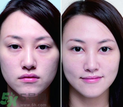 臥蠶是什么？臥蠶是眼袋嗎？