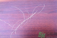 生完寶寶白頭發(fā)的原因？生完寶寶白頭發(fā)怎么辦？