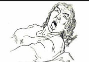 癲癇的發(fā)病因素？癲癇的并發(fā)癥有哪些？