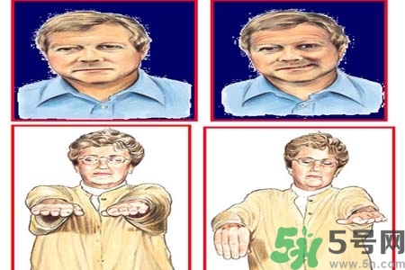 腦中風是什么？腦中風的癥狀？