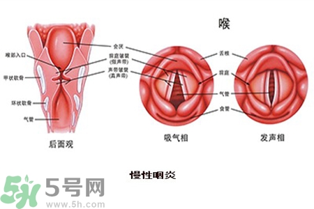 慢性咽炎是什么？慢性咽炎的癥狀有哪些？