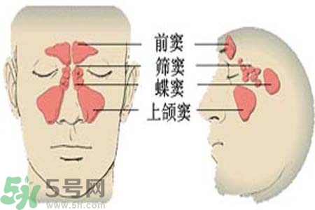 鼻竇炎是什么？鼻竇炎的癥狀有哪些？
