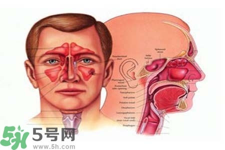 鼻竇炎的高發(fā)人群？如何預(yù)防鼻竇炎？