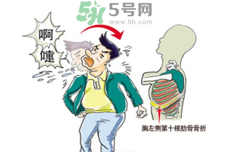 過敏性鼻炎是什么？過敏性鼻炎的癥狀有哪些？
