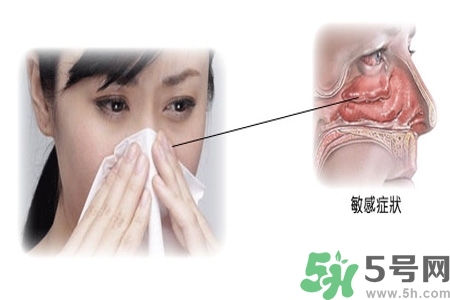 過(guò)敏性鼻炎的高發(fā)人群有哪些？如何預(yù)防過(guò)敏性鼻炎？