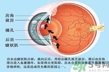 青光眼是什么？青光眼癥狀有什么？