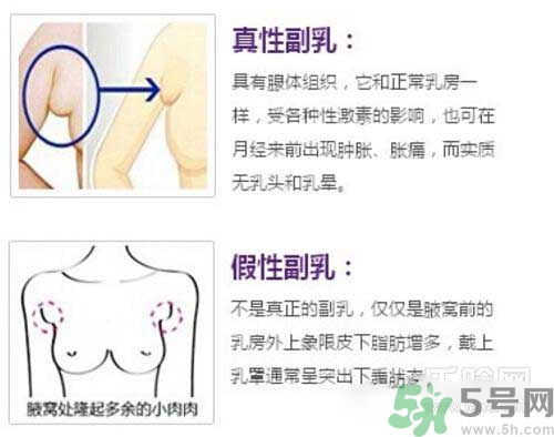 副乳是什么？副乳的危害