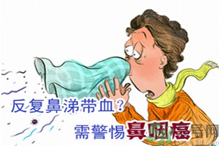 鼻咽癌是什么？鼻咽癌的癥狀有哪些？