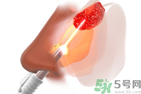 鼻咽癌的日常措施是什么？鼻咽癌注意的飲食有哪些？