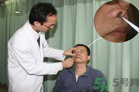 鼻咽癌的治療方法是什么？鼻咽癌可以用什么藥物治療？