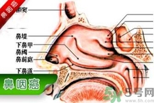 鼻咽癌的發(fā)病因素是什么？鼻咽癌的并發(fā)癥有哪些？