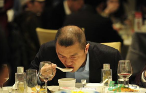男人禿頂會(huì)遺傳嗎？男人禿頂是腎虛嗎？