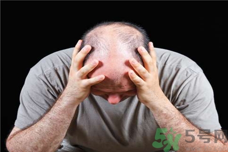 脫發(fā)的高發(fā)人群有哪些？如何預防脫發(fā)？