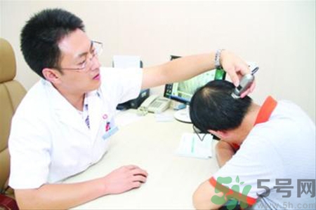 脫發(fā)會遺傳嗎？脫發(fā)遺傳可以治療嗎？