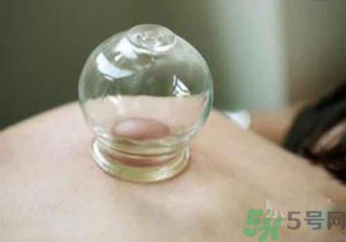 拔火罐和拔氣罐哪個好？拔火罐和拔氣罐的區(qū)別