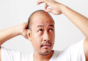 脫發(fā)的高發(fā)人群有哪些？如何預(yù)防脫發(fā)？