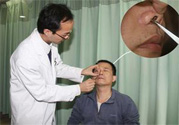 鼻咽癌的發(fā)病因素是什么？鼻咽癌的并發(fā)癥有哪些？